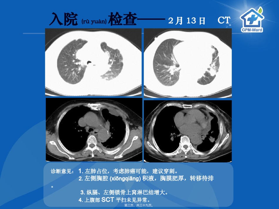 2022年医学专题—-16癌痛病例分享(郑大一附院王峰).ppt_第3页