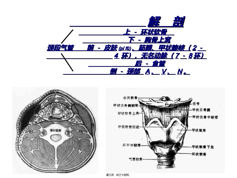 2022年医学专题—【印刷】气管切开术环甲膜穿刺术.ppt_第3页