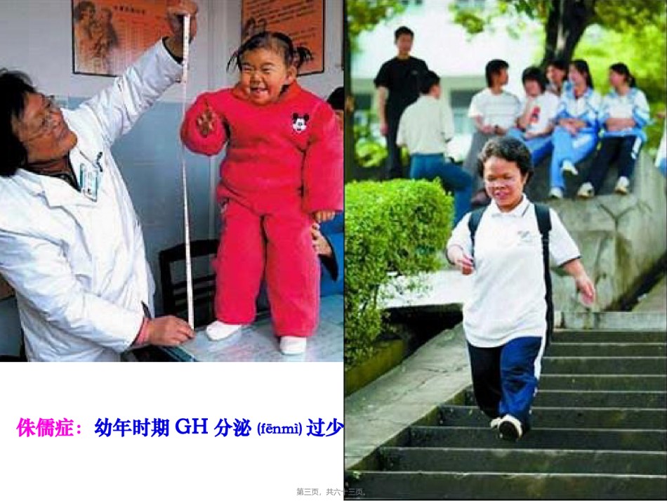 2022年医学专题—【组胚】9.内分泌系统.ppt_第3页