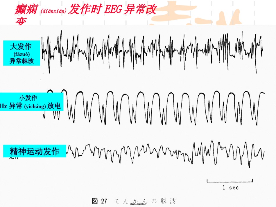 2022年医学专题—-抗癫痫药和抗惊厥药本-09.ppt_第3页