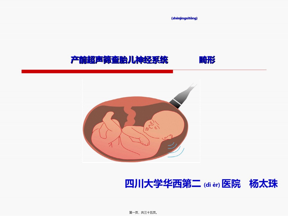 2022年医学专题—-杨太珠产前超声筛查胎儿神经系统畸形-2016.5.27.ppt_第1页