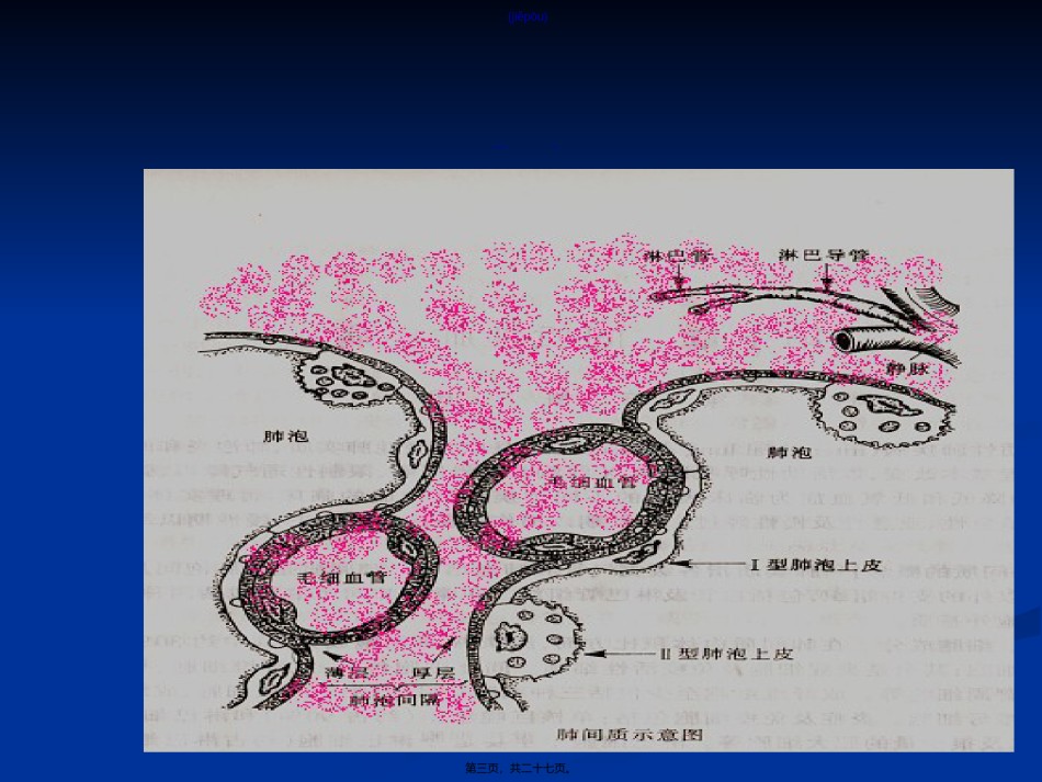 2022年医学专题—-特发性肺纤维化.ppt_第3页