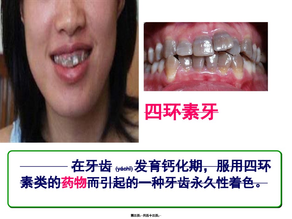 2022年医学专题—.2-用药与急救.ppt_第3页
