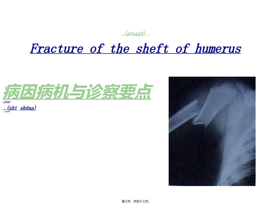2022年医学专题—.2第六章-第二节上肢骨折.ppt_第3页