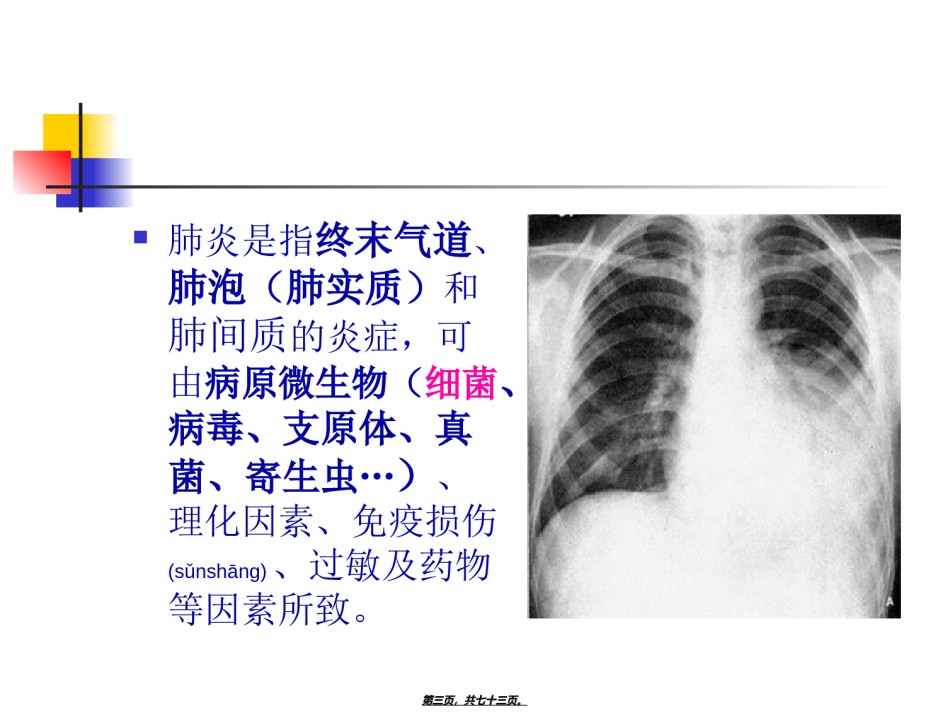 2022年医学专题—.肺炎概述.ppt_第3页