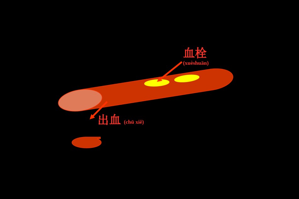2022年医学专题—.血栓与止血.ppt_第2页