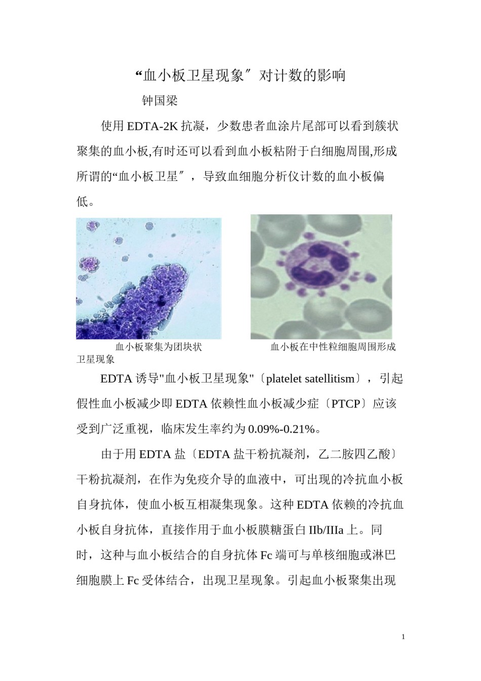 2022年医学专题—“血小板卫星”现象.docx_第1页