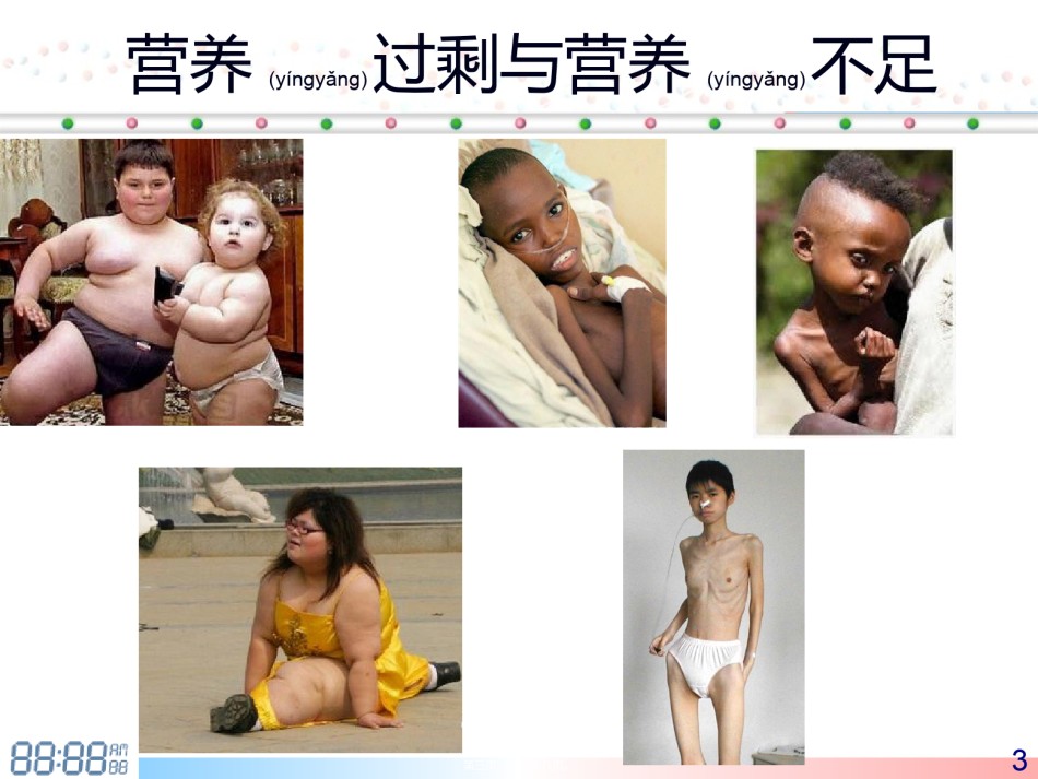 2022年医学专题—.1营养风险筛查与评估.ppt_第3页