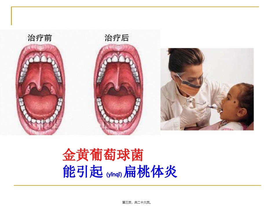 2022年医学专题—.2细菌PPT.ppt_第3页