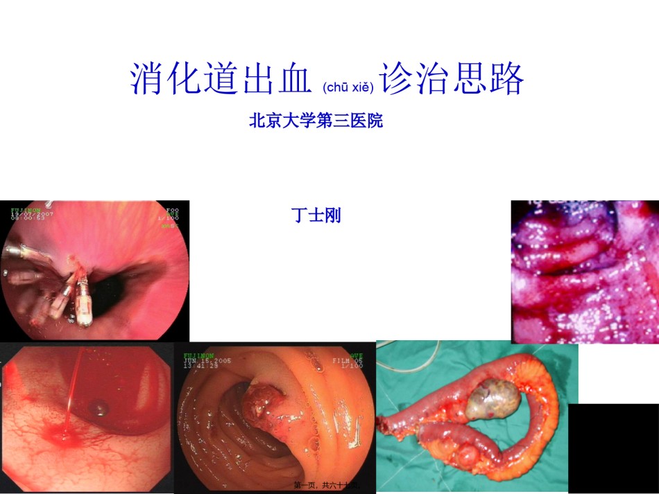 2022年医学专题—.消化道出血诊治思路(军总2010论坛北医三院消化科丁士刚).ppt_第1页