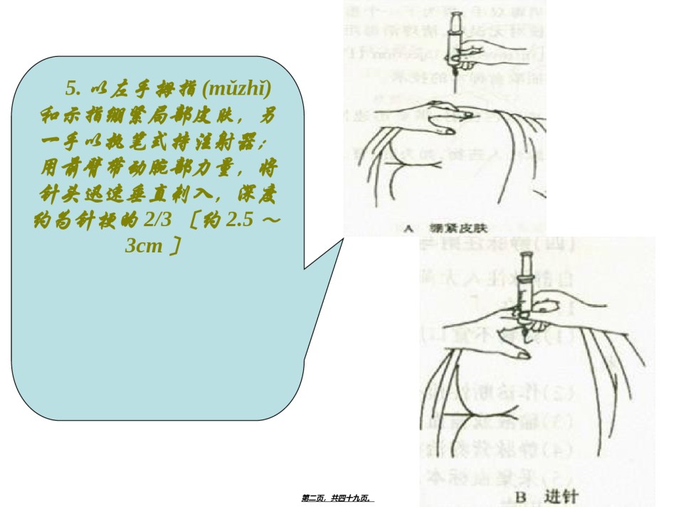 2022年医学专题—.以左手拇指和示指绷紧局部皮肤-另一手以执笔式持注射器.ppt_第2页