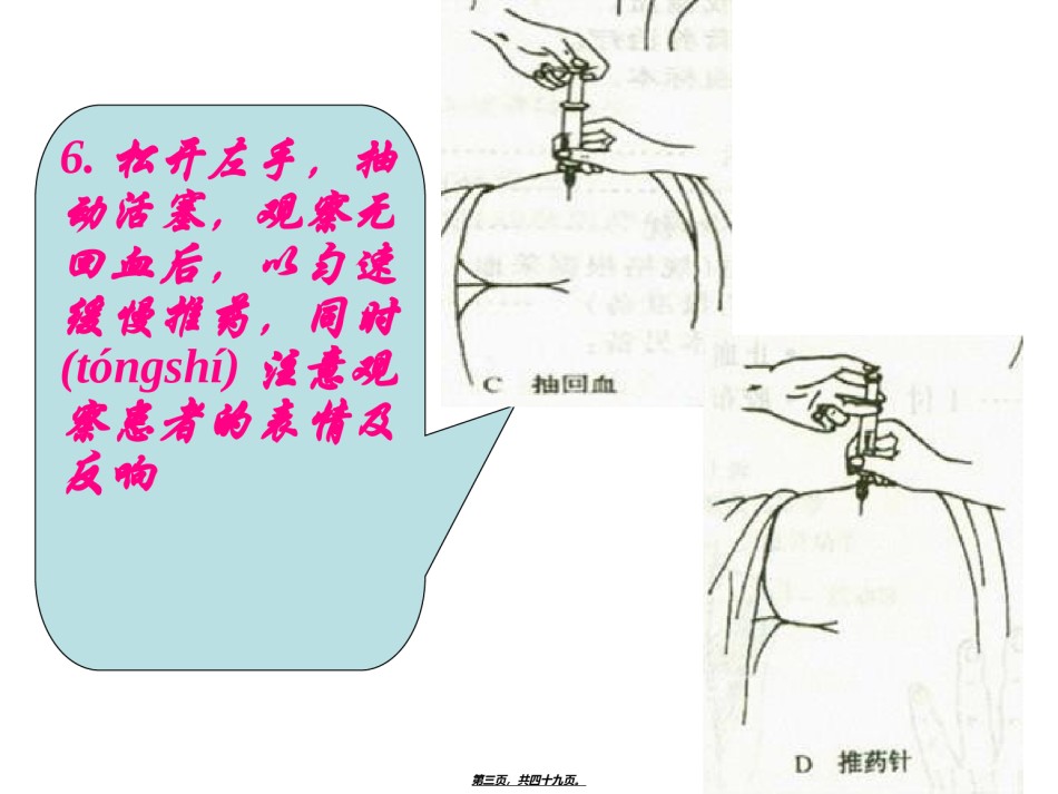 2022年医学专题—.以左手拇指和示指绷紧局部皮肤-另一手以执笔式持注射器.ppt_第3页