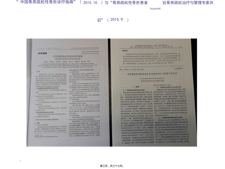 2022年医学专题—《中国骨质疏松性骨折诊疗指南》解读.ppt_第3页