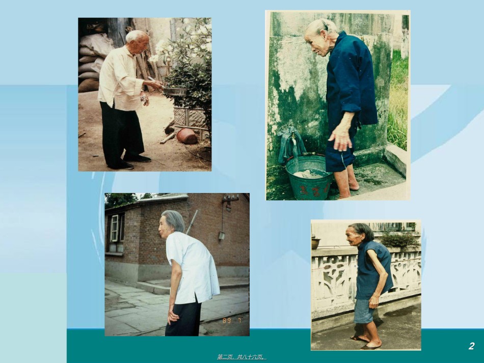 2022年医学专题—4+骨质疏松症的诊治进展20121126.ppt_第2页