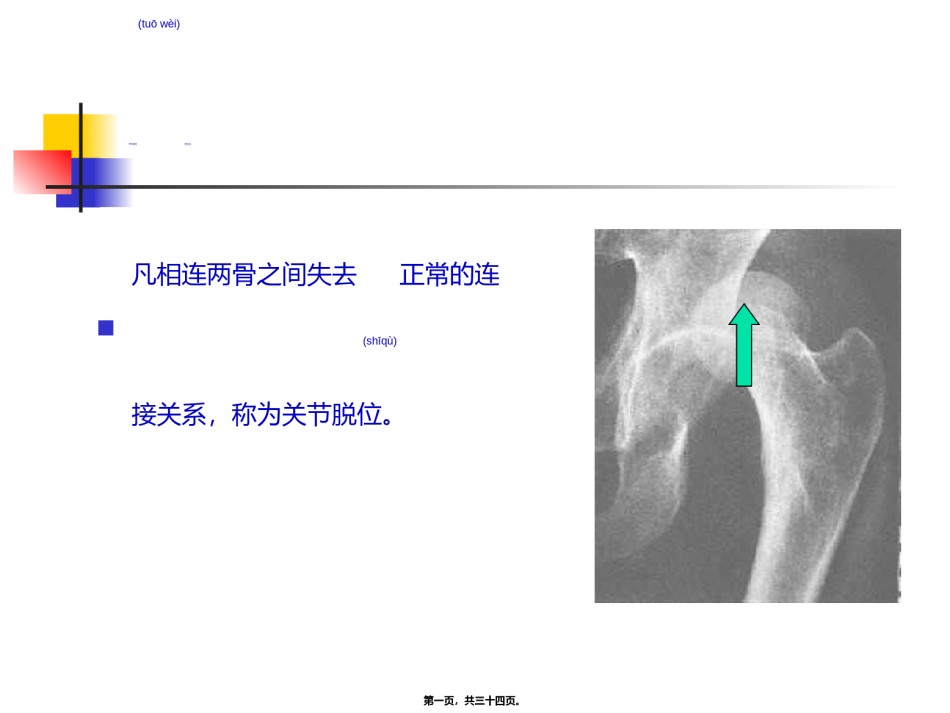 2022年医学专题—5关节脱位的急救.ppt_第1页