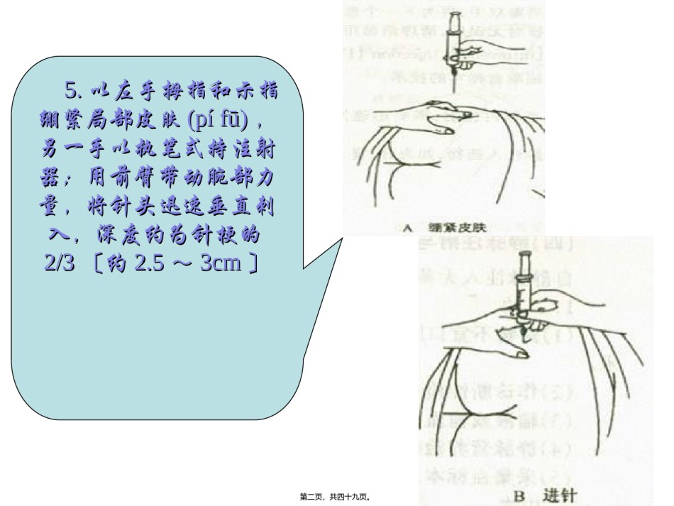 2022年医学专题—5以左手拇指和示指绷紧局部皮肤-另一手以执笔式持注射器.ppt_第2页