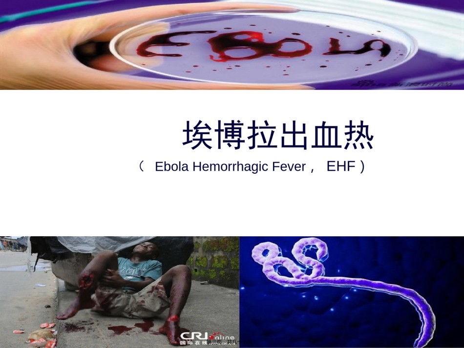 2022年医学专题—埃博拉疫情及秋冬常见传染病的防护.ppt_第3页