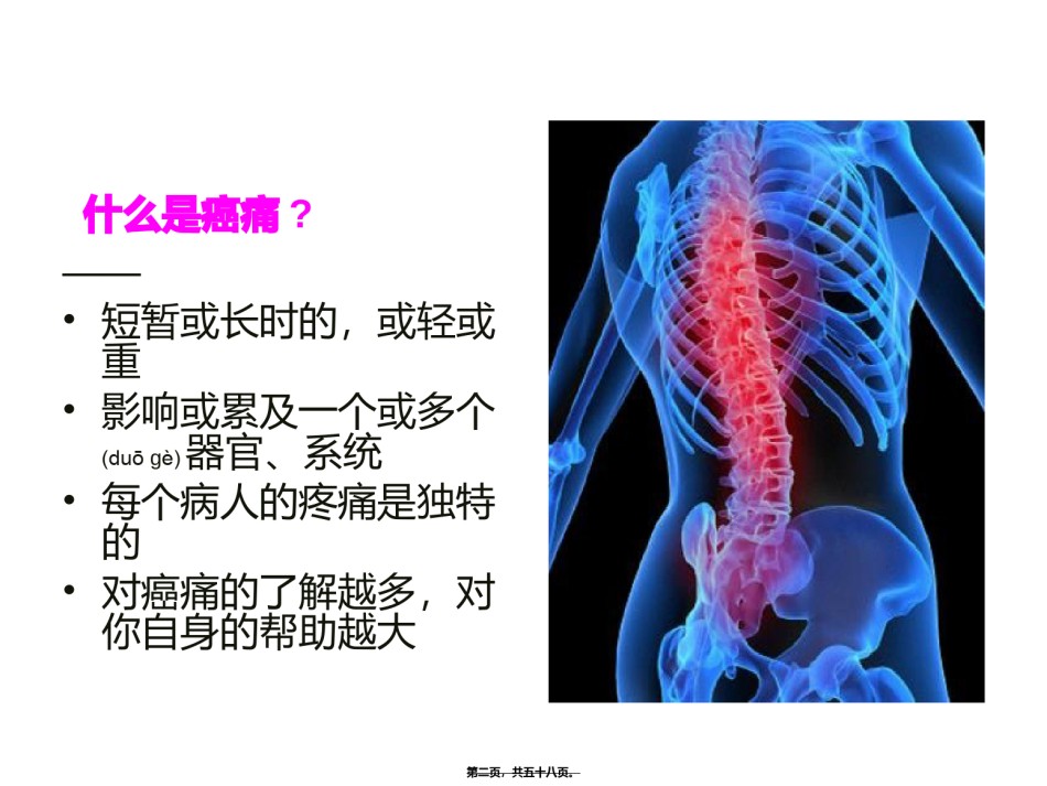 2022年医学专题—癌痛综合处理.ppt_第2页