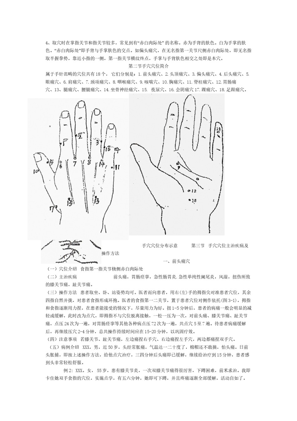 2022年医学专题—爱爱医资源-手穴十八针法李茂发.docx_第2页