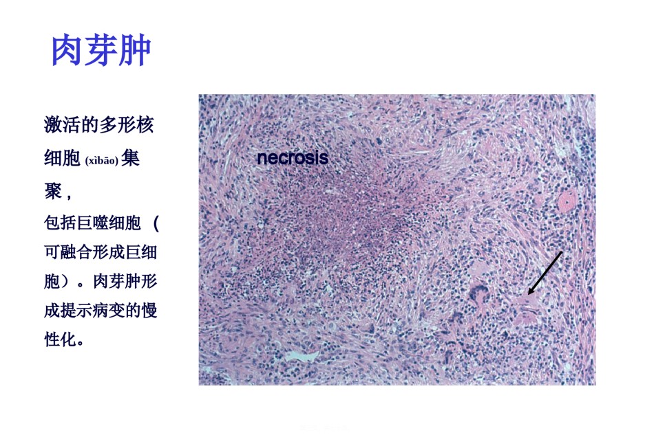 2022年医学专题—爱爱医资源-系统性血管炎2013.ppt_第3页