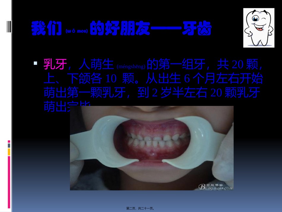 2022年医学专题—爱护牙齿-从现在做起.pptx_第2页
