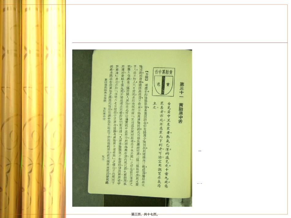 2022年医学专题—敖氏伤寒金镜录.ppt_第3页