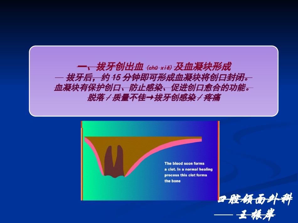 2022年医学专题—拔牙创出血及血凝块形成拔牙后-山东大学.ppt_第3页