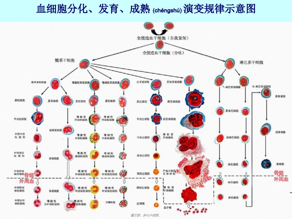 2022年医学专题—白--血--病(姚).ppt_第3页