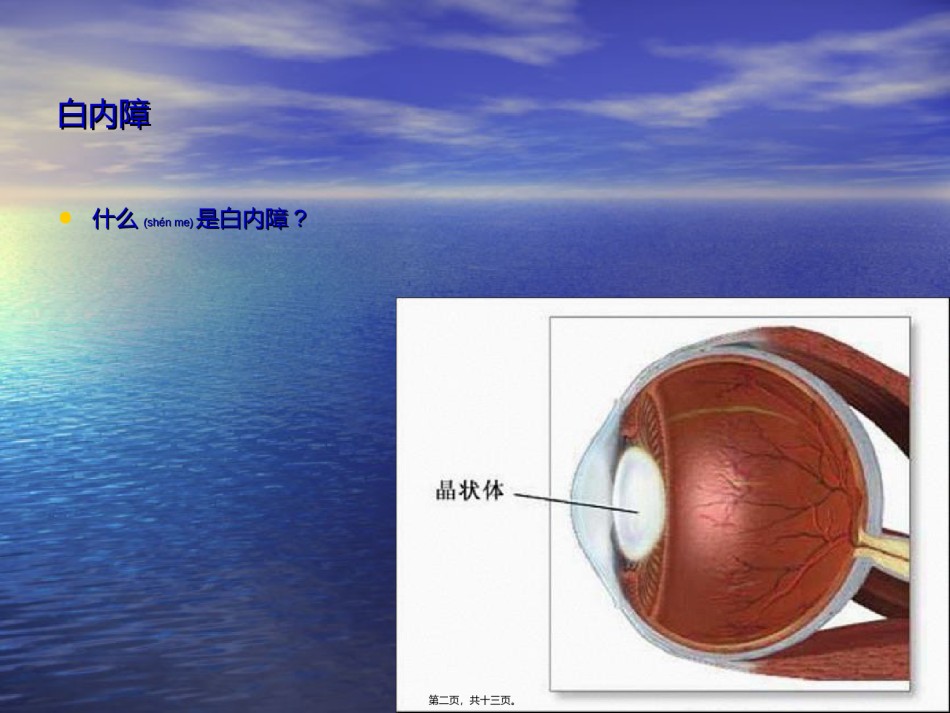 2022年医学专题—白内障-玻璃体混浊.ppt_第2页