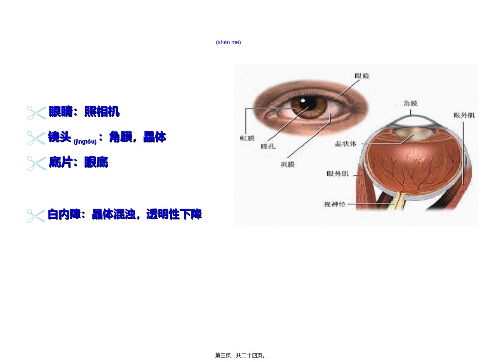 2022年医学专题—白内障.ppt_第3页