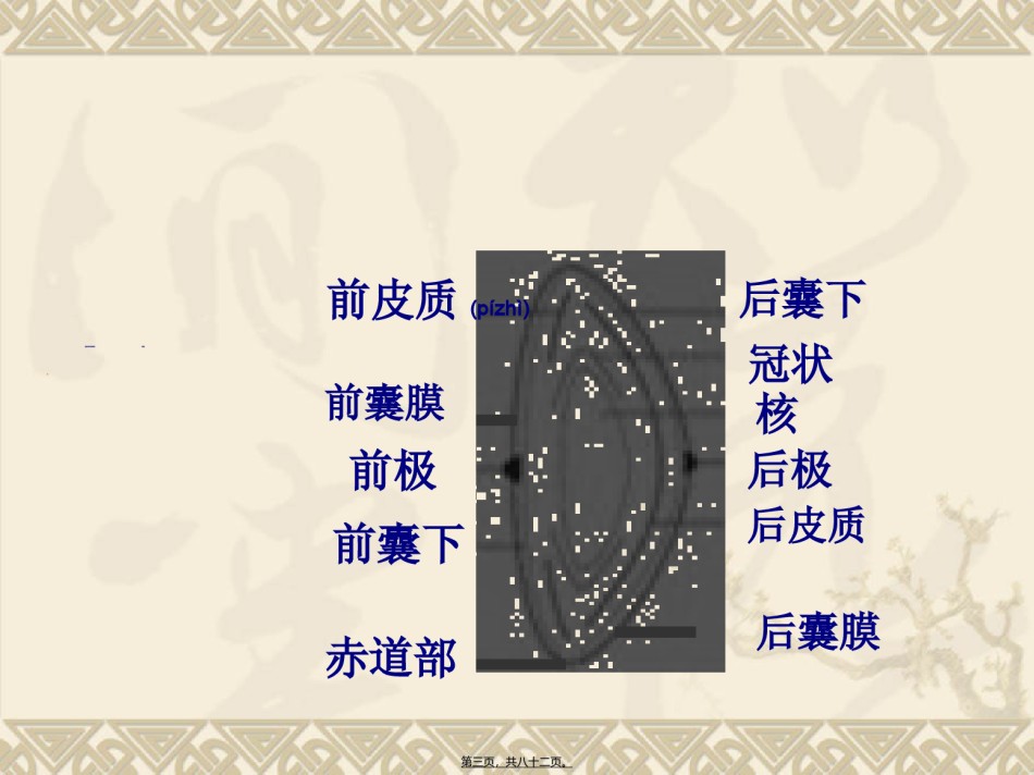 2022年医学专题—白内障(第七版)本科-黎宗汉.ppt_第3页