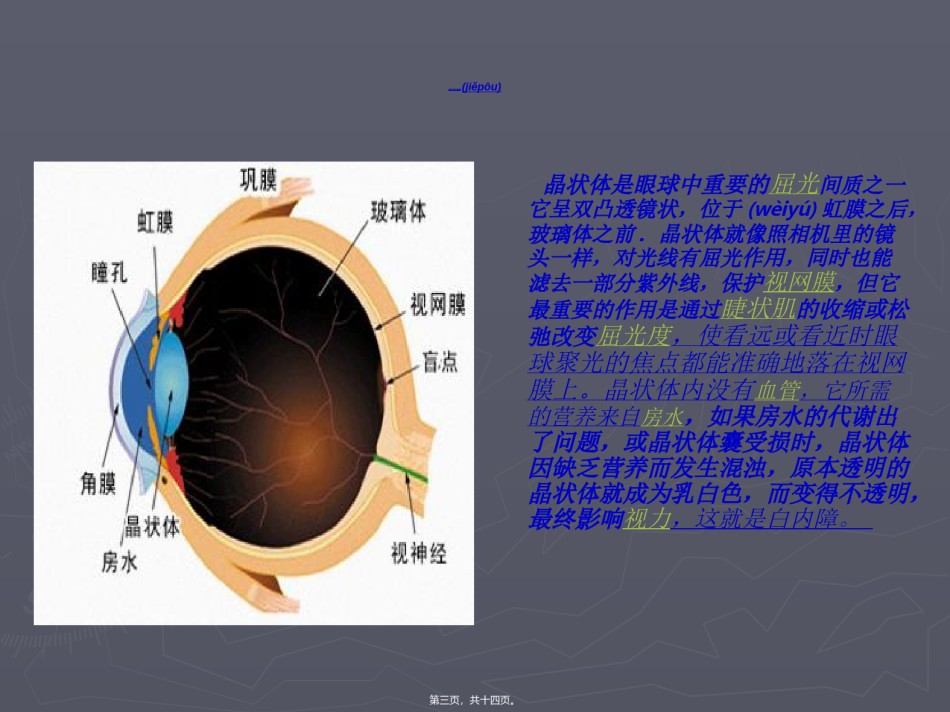 2022年医学专题—白内障超声乳化.ppt_第3页