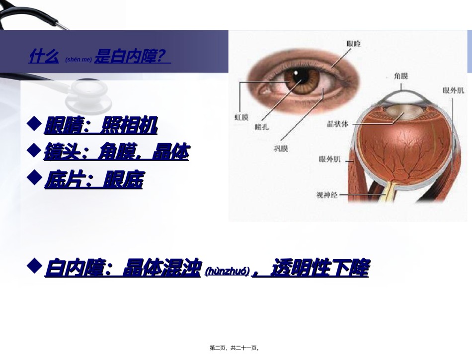 2022年医学专题—白内障的科普介绍.ppt_第2页