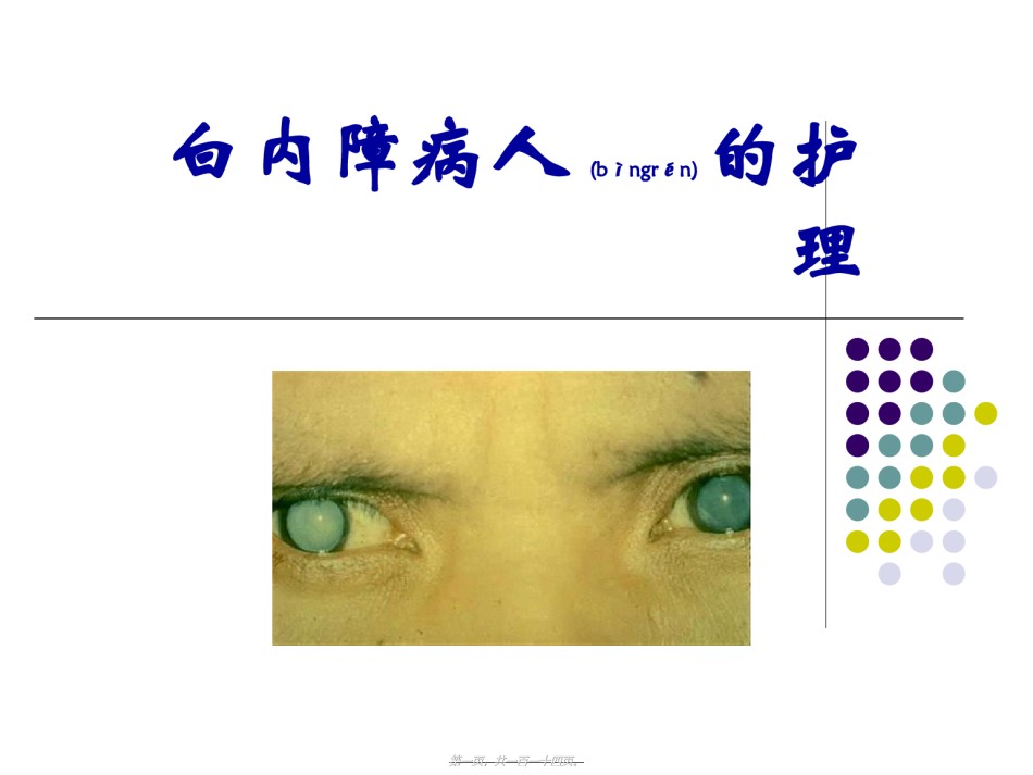 2022年医学专题—白内障青光眼.ppt_第1页