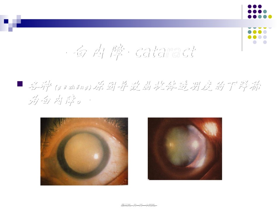 2022年医学专题—白内障青光眼.ppt_第3页