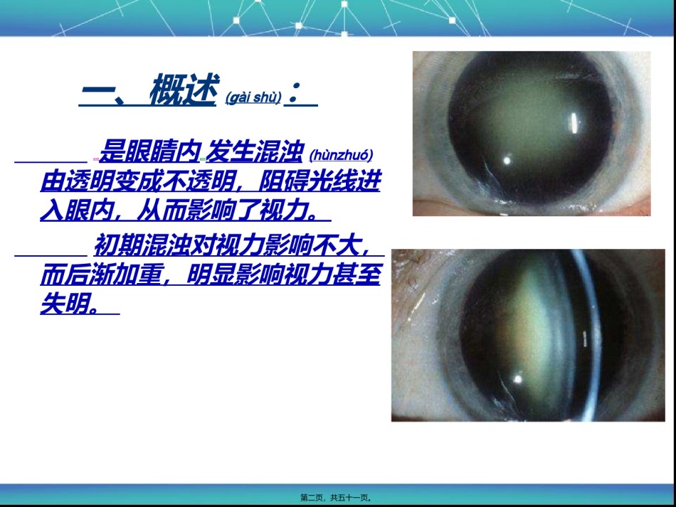 2022年医学专题—白内障bcr..ppt_第2页