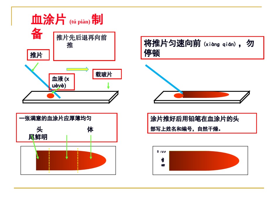 2022年医学专题—白细胞分类计数.ppt_第3页