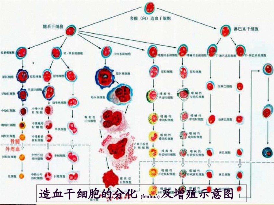 2022年医学专题—白血病讲课2PPT.ppt_第3页