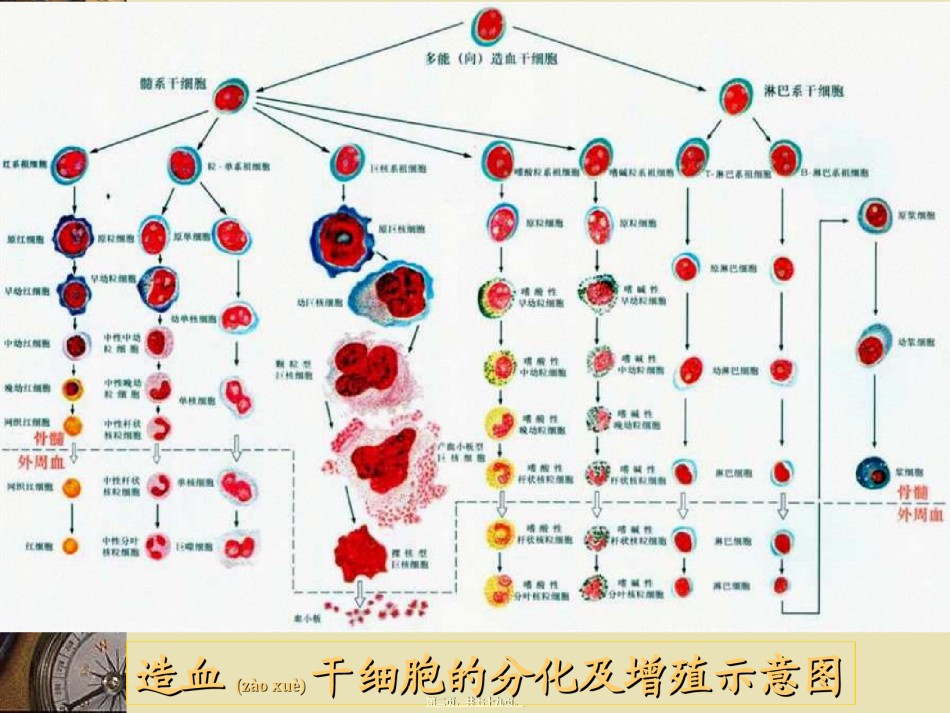 2022年医学专题—白血病讲课PPT.ppt_第2页
