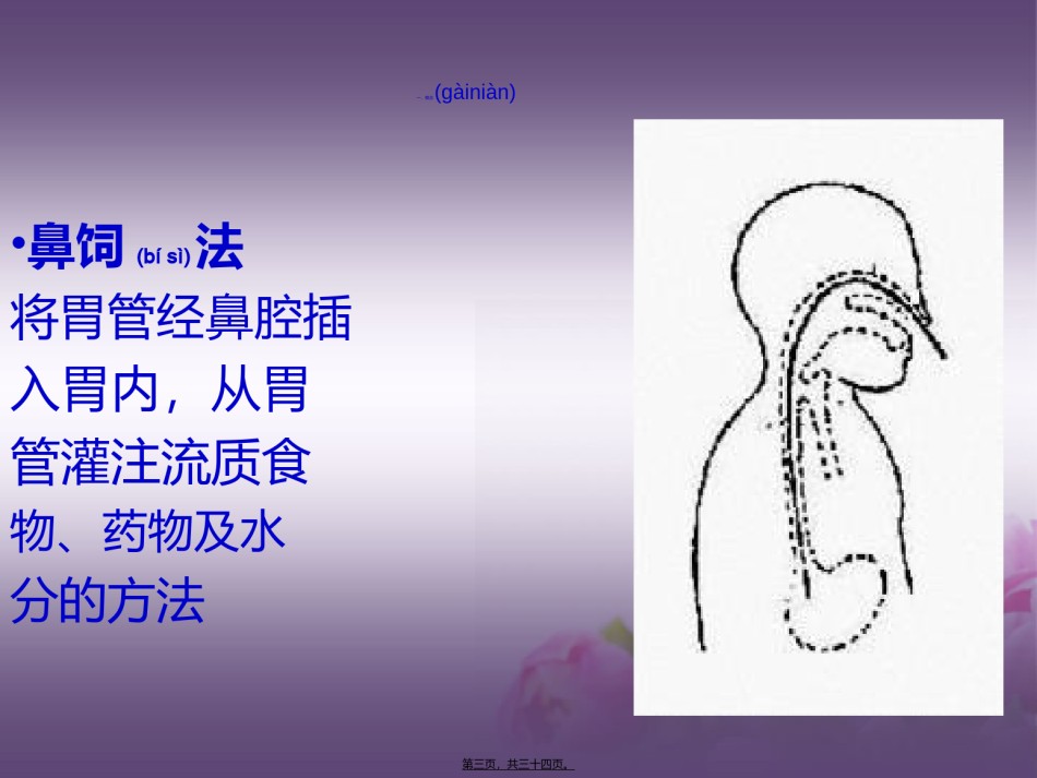 2022年医学专题—版鼻饲法操作PPT.ppt_第3页