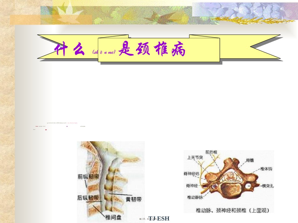 2022年医学专题—办公室颈椎操PPT模板.ppt_第2页