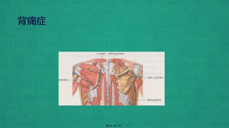 2022年医学专题—背痛症.pptx_第3页
