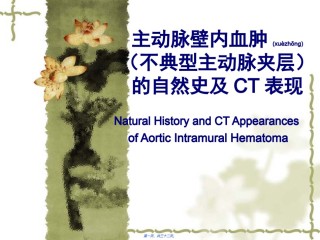2022年医学专题—壁内血肿演变及CT表现(讲课).ppt