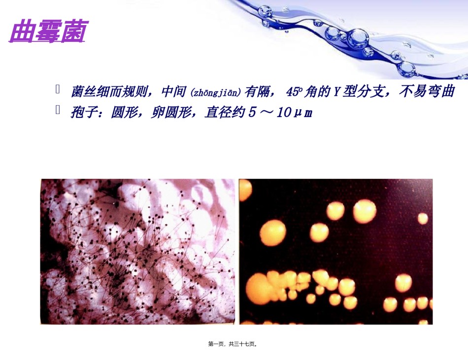 2022年医学专题—变应性支气管肺曲霉菌病ABPA.ppt_第1页