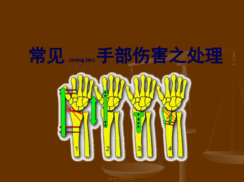 2022年医学专题—常见手部伤害的处理共31页.ppt_第1页