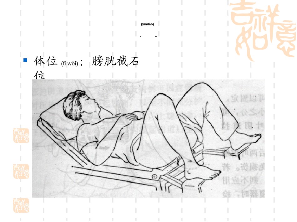 2022年医学专题—常用妇科检查方法.ppt_第3页