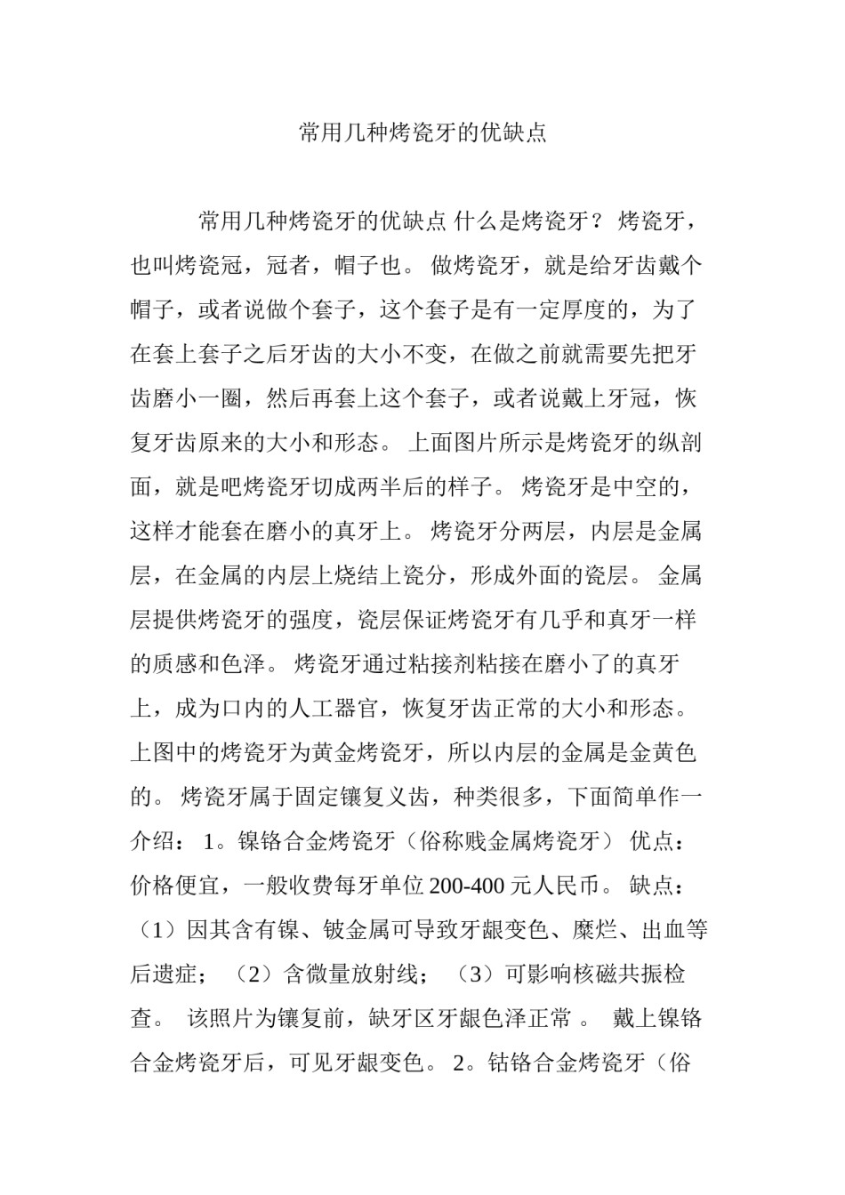 2022年医学专题—常用几种烤瓷牙的优缺点.docx_第1页