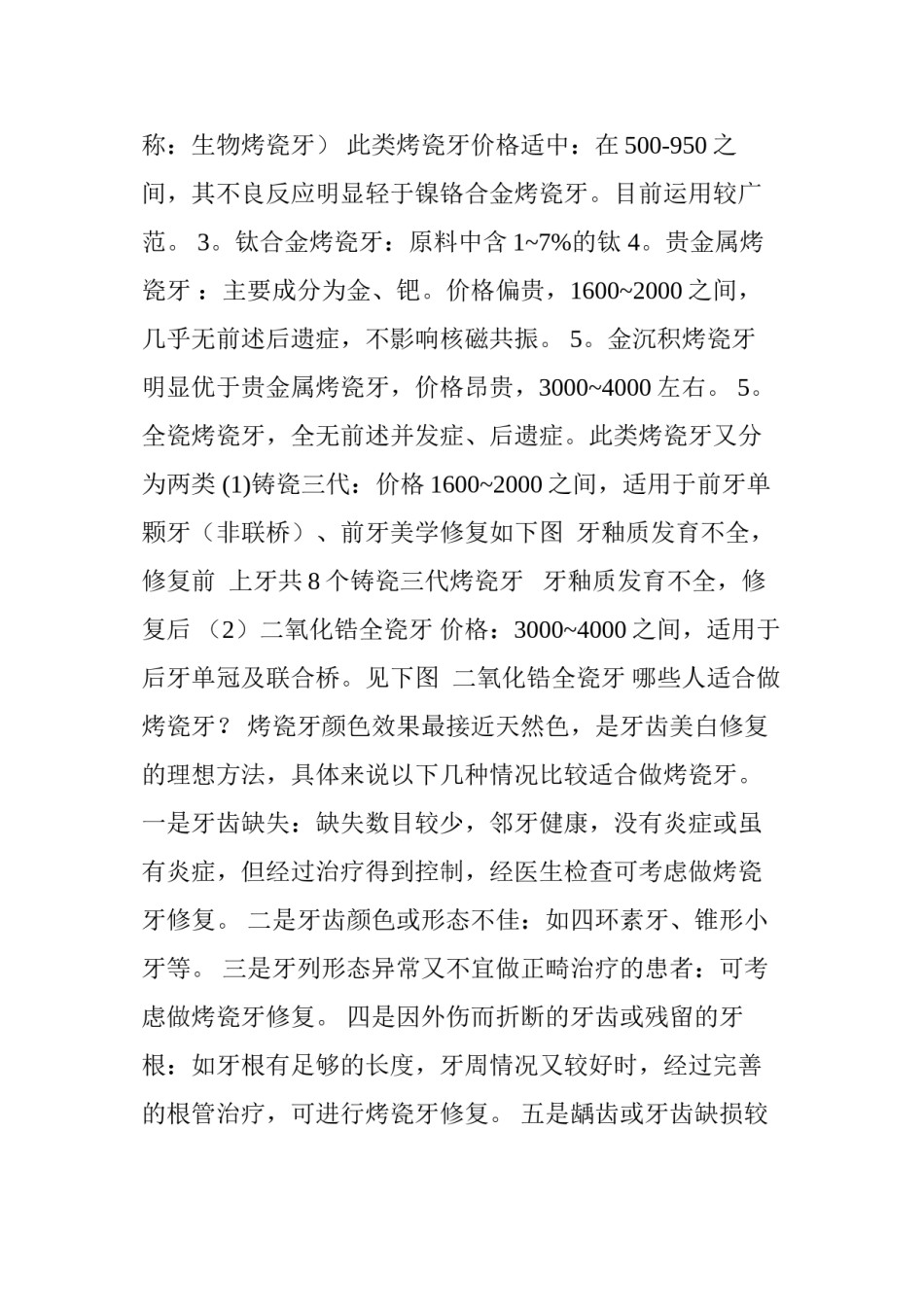 2022年医学专题—常用几种烤瓷牙的优缺点.docx_第2页