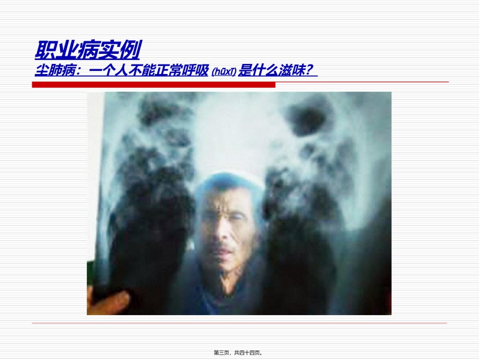2022年医学专题—尘肺病防治防治常.ppt_第3页
