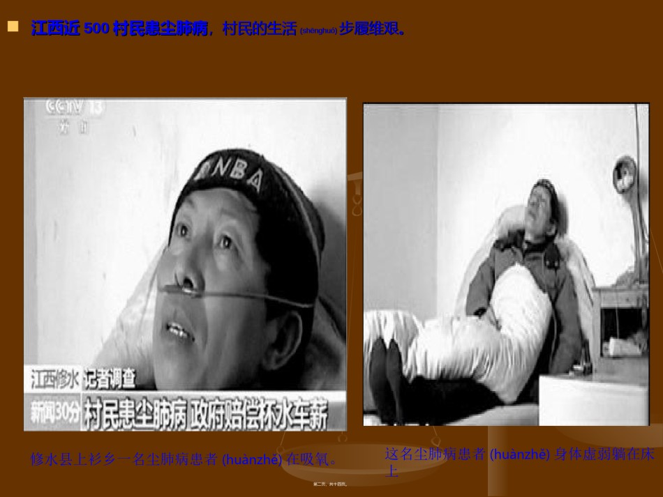 2022年医学专题—尘肺之痛ppt.ppt_第2页